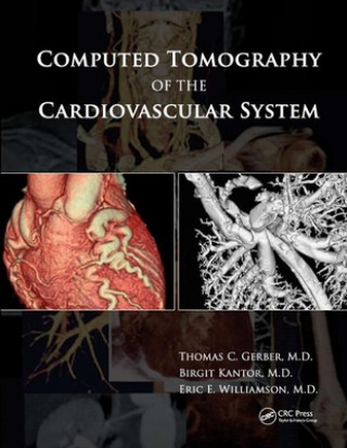 Kniha Computed Tomography of the Cardiovascular System 