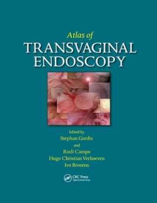 Carte Atlas of Transvaginal Endoscopy 
