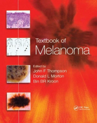 Kniha Textbook of Melanoma 