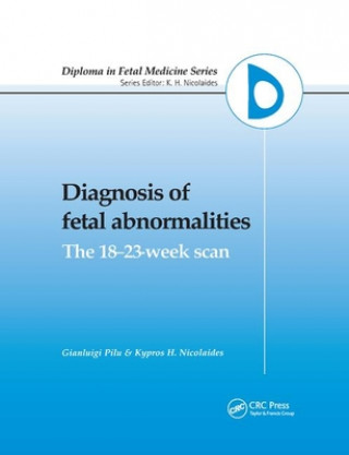 Kniha Diagnosis of Fetal Abnormalities 