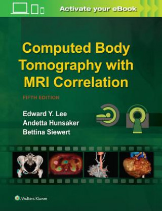 Książka Computed Body Tomography with MRI Correlation Edward Y. Lee