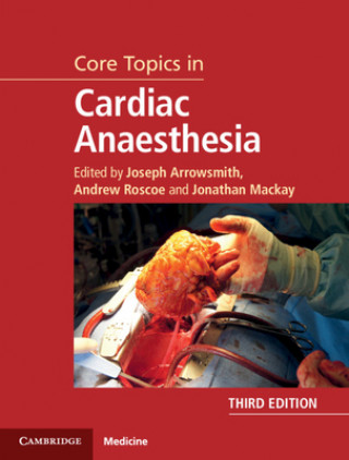 Könyv Core Topics in Cardiac Anaesthesia Joseph Arrowsmith