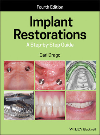 Книга Implant Restorations Carl Drago