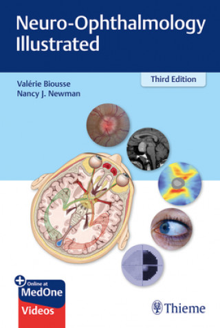 Knjiga Neuro-Ophthalmology Illustrated Valerie Biousse
