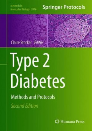 Kniha Type 2 Diabetes Claire J. Stocker