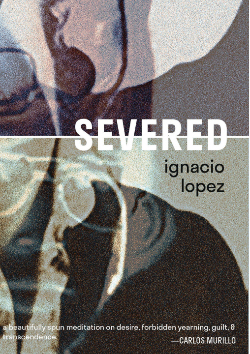 Buch Severed Ignacio Lopez