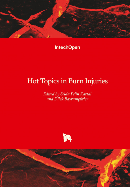 Kniha Hot Topics in Burn Injuries Selda Pelin Kartal