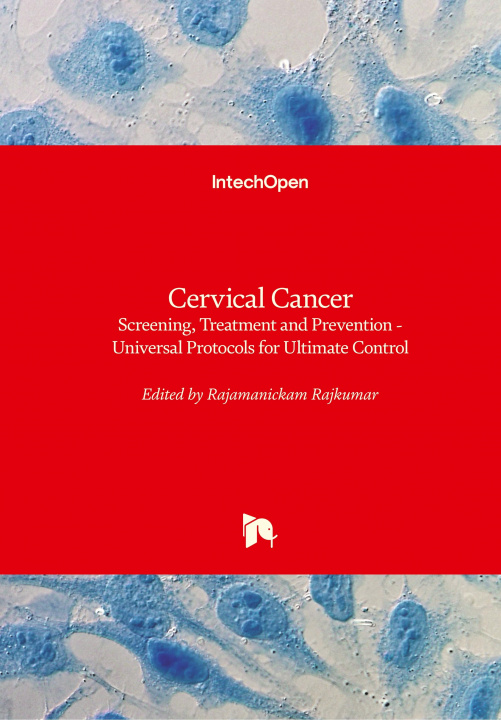 Knjiga Cervical Cancer Rajamanickam Rajkumar
