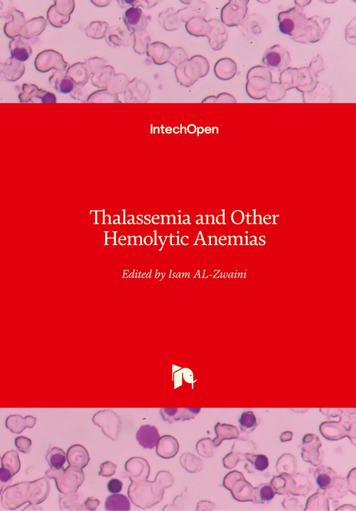 Kniha Thalassemia and Other Hemolytic Anemias Isam Jaber Al-Zwaini