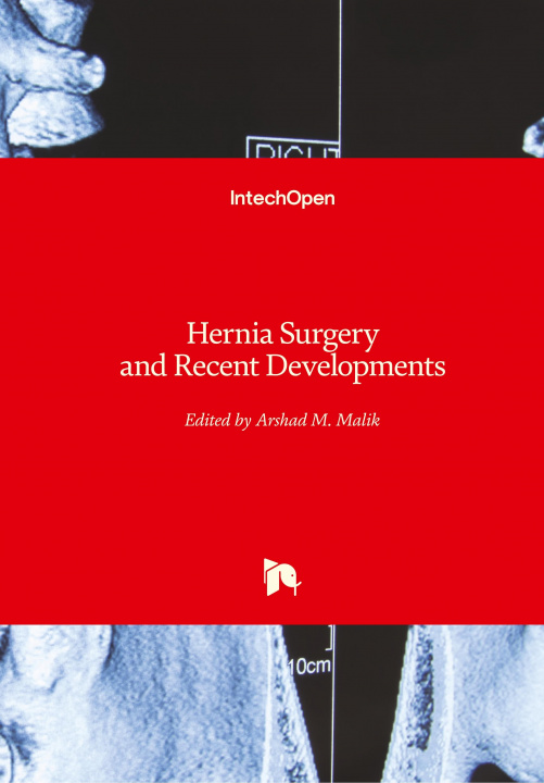 Carte Hernia Surgery and Recent Developments Arshad M. Malik