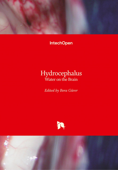 Livre Hydrocephalus Bora Gürer