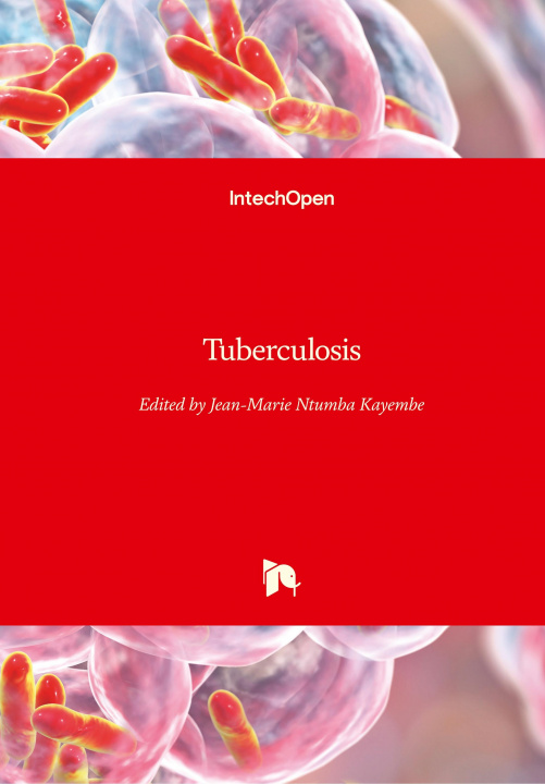 Kniha Tuberculosis Jean-Marie Kayembe