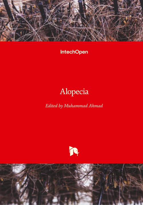 Knjiga Alopecia Muhammad Ahmad