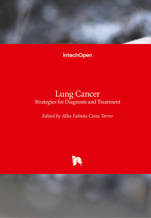 Kniha Lung Cancer Alba Fabiola Costa Torres