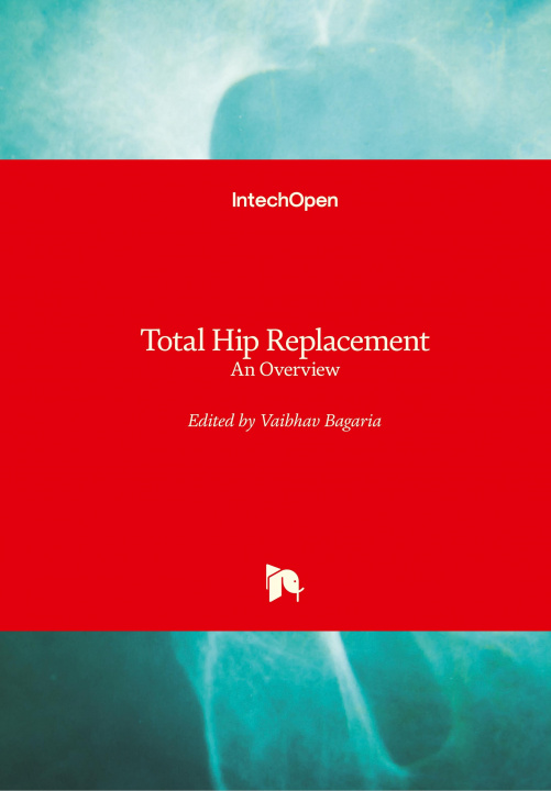 Kniha Total Hip Replacement Vaibhav Bagaria