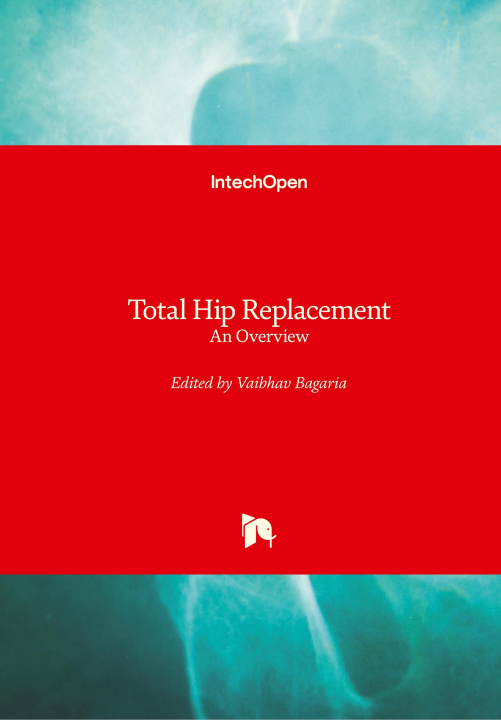 Book Total Hip Replacement Vaibhav Bagaria