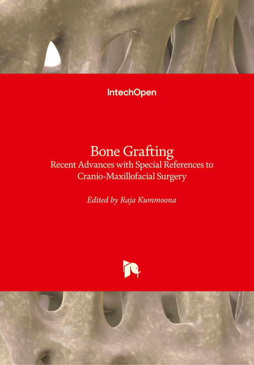 Książka Bone Grafting Raja Kummoona