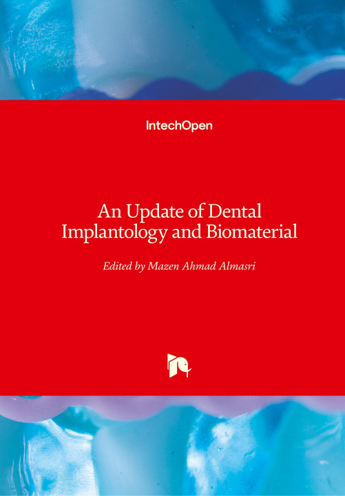 Carte Update of Dental Implantology and Biomaterial Mazen Ahmad Almasri