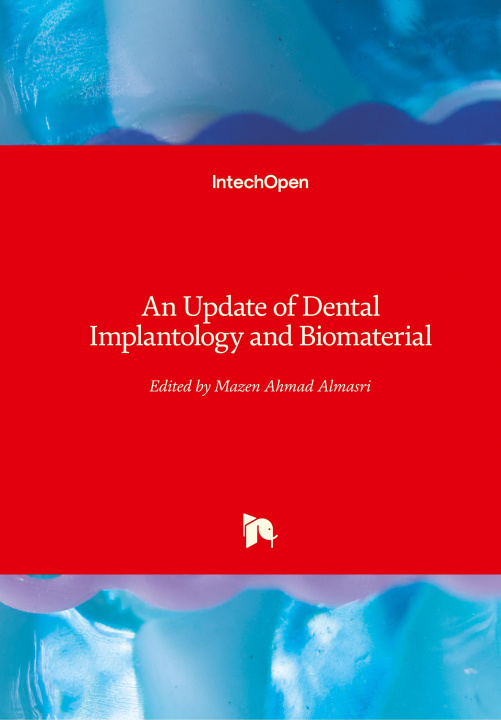 Knjiga Update of Dental Implantology and Biomaterial Mazen Ahmad Almasri