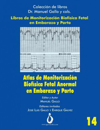 Könyv Atlas de Monitorizacion Biofisica Fetal Anormal En El Embarazo Y Parto Manuel Gallo