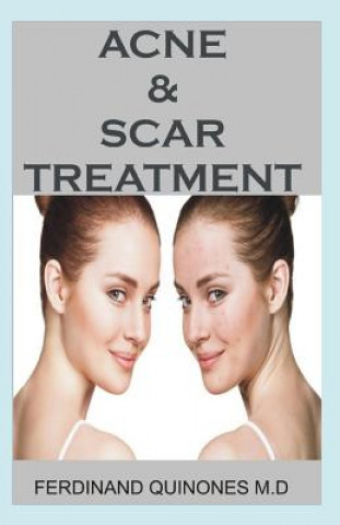 Könyv Acne & Scar Treatment: All You Need to about Curing Acne with Ease, Quickly and Naturally. Ferdinand Quinones MD