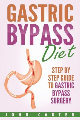 Könyv Gastric Bypass Diet John Carter