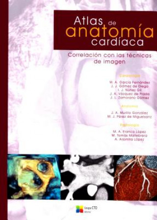 Kniha Atlas de Anatomia Cardiaca Mario Jorge Diaz