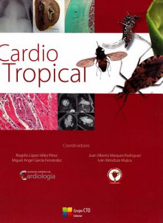 Książka Cardio Tropical Rogelio Lopez-Velez Perez