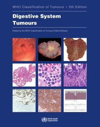 Kniha Digestive System Tumours: Who Classification of Tumours Who Classification of Tumours Editorial