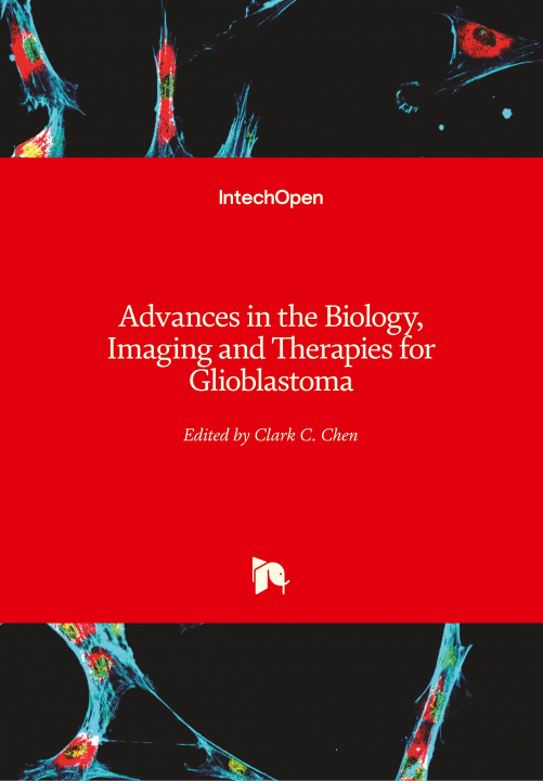 Carte Advances in the Biology, Imaging and Therapies for Glioblastoma Clark Chen