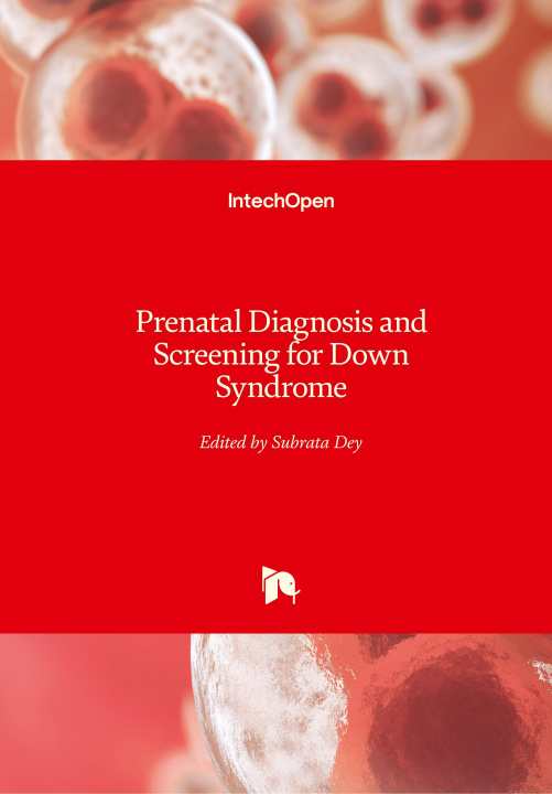 Knjiga Prenatal Diagnosis and Screening for Down Syndrome Subrata Dey