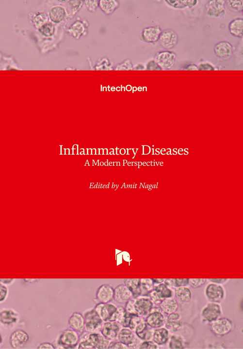 Książka Inflammatory Diseases Amit Nagal