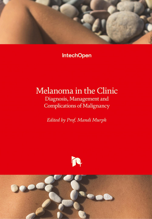 Knjiga Melanoma in the Clinic Mandi Murph