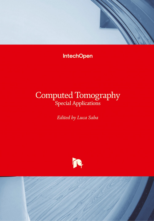 Knjiga Computed Tomography Luca Saba
