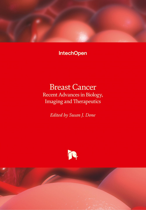 Carte Breast Cancer Susan Done