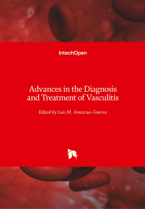 Książka Advances in the Diagnosis and Treatment of Vasculitis Luis M Amezcua-Guerra