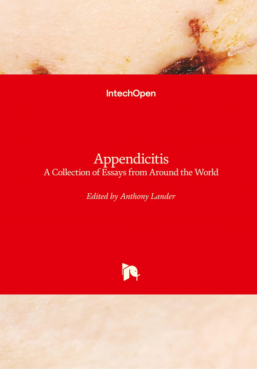 Knjiga Appendicitis Anthony Lander
