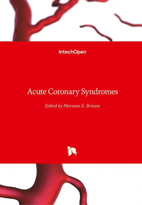 Kniha Acute Coronary Syndromes Mariano Brizzio