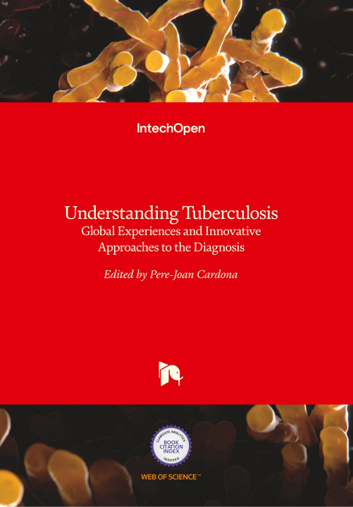 Book Understanding Tuberculosis Pere-Joan Cardona
