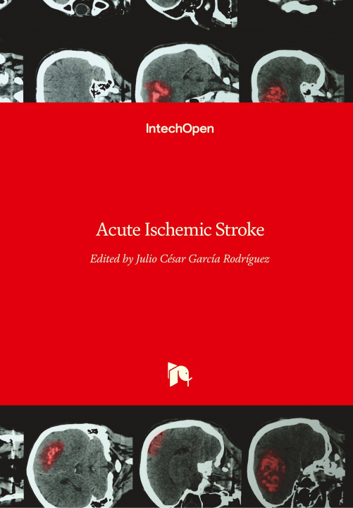 Knjiga Acute Ischemic Stroke Julio Cesar Garcia Rodriguez