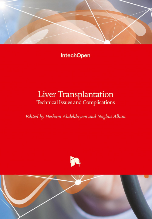 Buch Liver Transplantation Hesham Abdeldayem