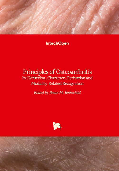 Könyv Principles of Osteoarthritis Bruce M. Rothschild