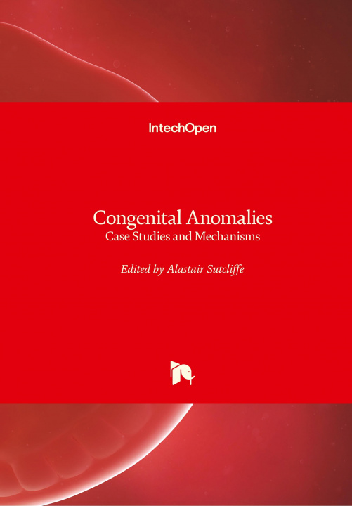 Knjiga Congenital Anomalies Alastair Sutcliffe
