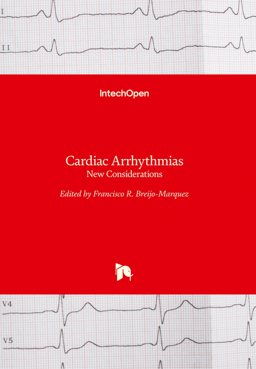 Könyv Cardiac Arrhythmias Francisco R. Breijo-Marquez