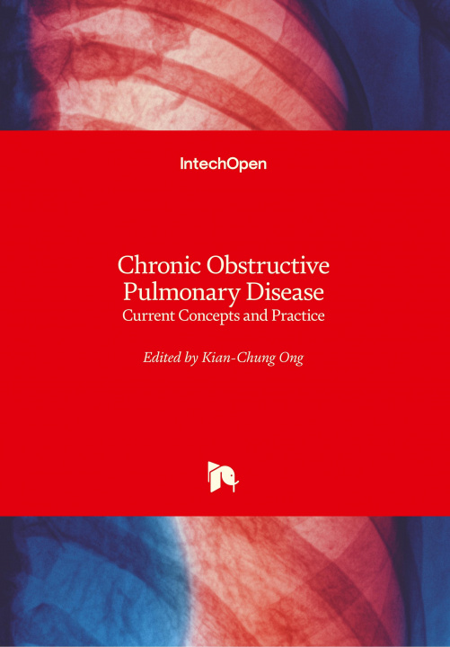 Kniha Chronic Obstructive Pulmonary Disease Kian Chung Ong