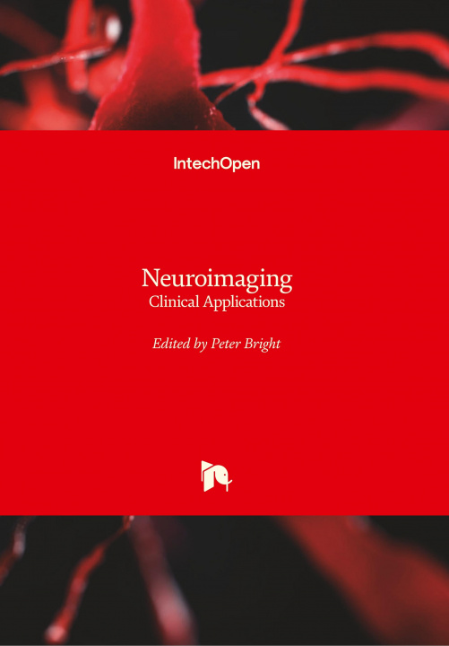 Kniha Neuroimaging Peter Bright