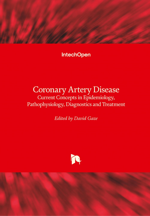 Könyv Coronary Artery Disease David C. Gaze