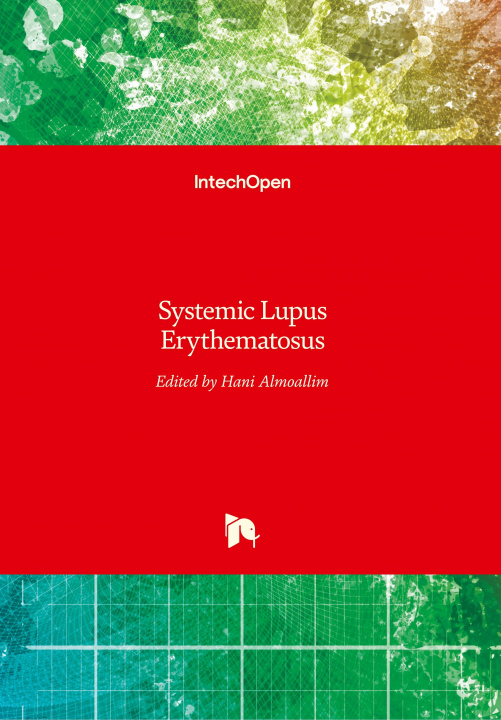 Kniha Systemic Lupus Erythematosus Hani Almoallim