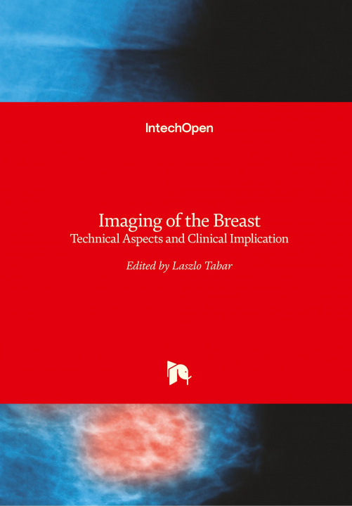 Kniha Imaging of the Breast Laszlo Tabar
