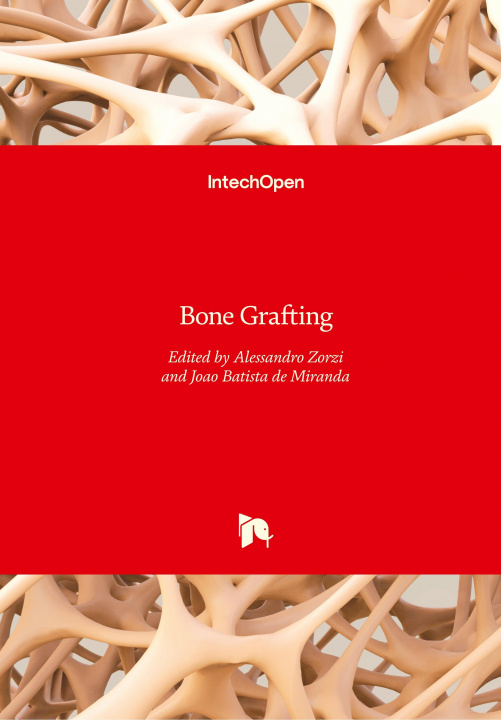 Könyv Bone Grafting Alessandro Rozim Zorzi